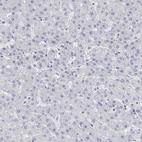 Immunohistochemical staining of human liver shows low expression as expected.