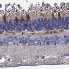 Anti-GRK7 Antibody