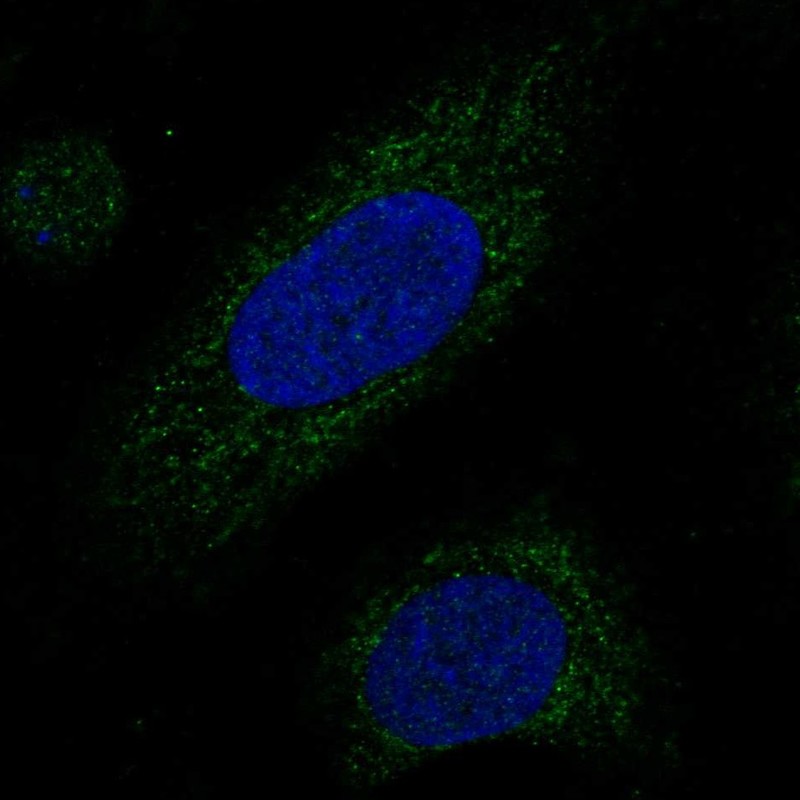 Anti-MRPL38 Antibody