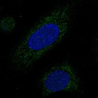Anti-MRPL38 Antibody