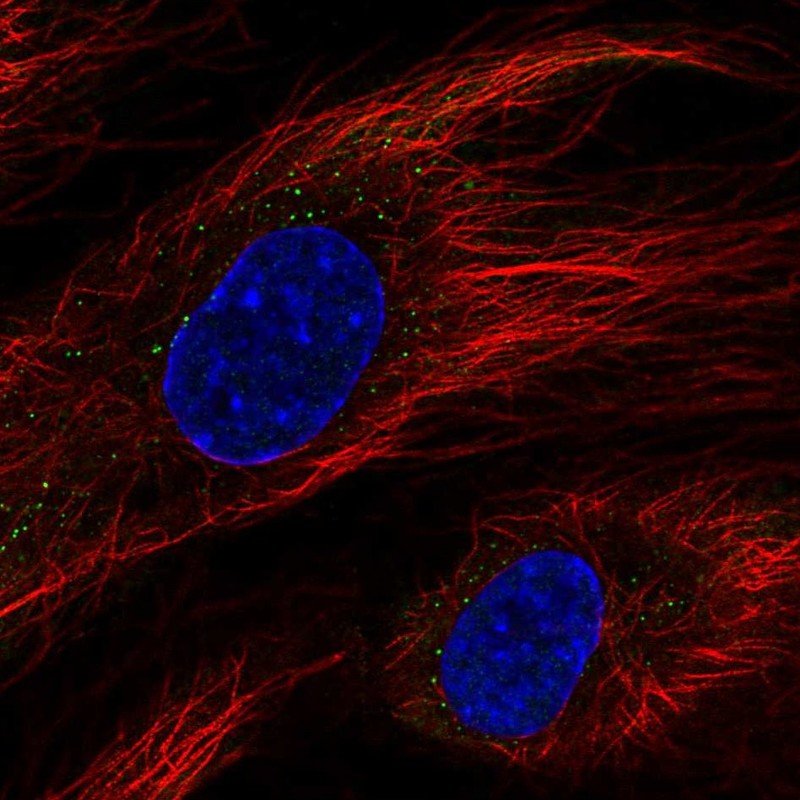 Anti-BCL6B Antibody