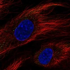 Anti-BCL6B Antibody