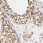 Anti-ILF3 Antibody