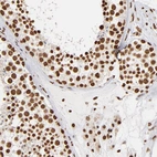 Anti-ILF3 Antibody