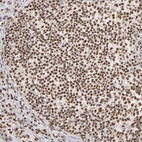 Immunohistochemical staining of human lymph node shows strong nuclear positivity in germinal center cells.