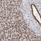 Immunohistochemical staining of human pancreas shows strong nuclear positivity in exocrine glandular cells.