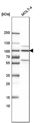 Anti-ILF3 Antibody