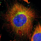 Immunofluorescent staining of human cell line U-251 MG shows localization to plasma membrane, cytosol & the Golgi apparatus.
