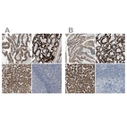 Immunohistochemical staining of human gastrointestinal, kidney, liver and lymph node using Anti-MARC2 antibody HPA017572 (A) shows similar protein distribution across tissues to independent antibody HPA015085 (B).
