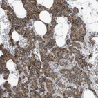 Immunohistochemical staining of human Parathyroid gland shows strong granular cytoplasmic positivity in glandular cells.