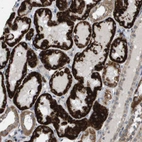 Immunohistochemical staining of human Kidney shows strong granular cytoplasmic positivity in cells in tubules.
