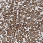 Immunohistochemical staining of human Liver shows strong granular cytoplasmic positivity in hepatocytes.