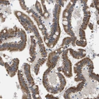 Immunohistochemical staining of human Duodenum shows moderate granular cytoplasmic positivity in glandular cells.