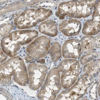 Immunohistochemical staining of human kidney shows moderate to strong cytoplasmic positivity in cells in tubules.