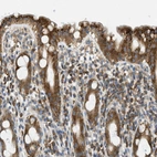 Immunohistochemical staining of human rectum shows moderate to strong cytoplasmic positivity in glandular cells.