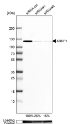 Western blot analysis in Caco-2 cells transfected with control siRNA, target specific siRNA probe #1 and #2, using Anti-ABCF1 antibody. Remaining relative intensity is presented. Loading control: Anti-GAPDH.