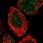 Immunofluorescent staining of human cell line A-431 shows localization to cytosol & centrosome.
