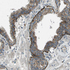 Anti-MIGA1 Antibody