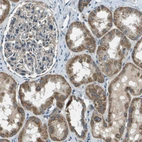 Immunohistochemical staining of human kidney shows moderate granular cytoplasmic positivity in cells in tubules.