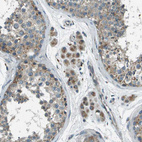 Anti-MIGA1 Antibody