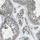Immunohistochemical staining of human testis shows moderate granular cytoplasmic positivity in Leydig cells.