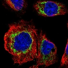 Immunofluorescent staining of human cell line A-431 shows localization to mitochondria.