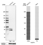 Western blot analysis in human cell lines Caco-2 and HeLa using Anti-NUDT4 antibody. Corresponding NUDT4 RNA-seq data are presented for the same cell lines. Loading control: Anti-GAPDH.
