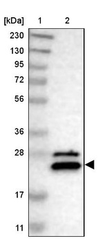 Lane 1: Marker [kDa] 230, 130, 95, 72, 56, 36, 28, 17, 11_br/_Lane 2: Human cell line RT-4