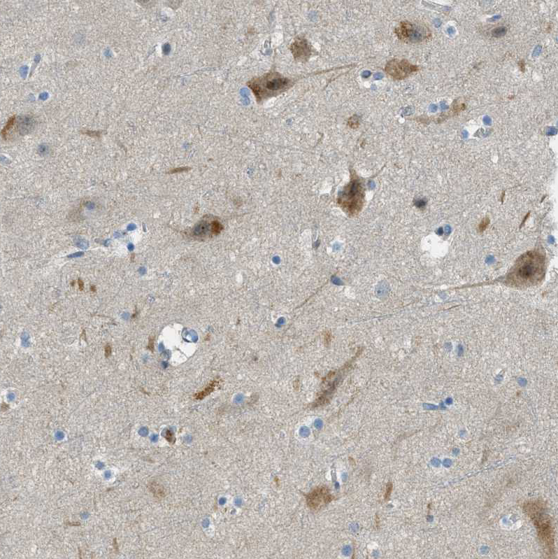 Anti-SNX14 Antibody