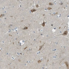 Anti-SNX14 Antibody