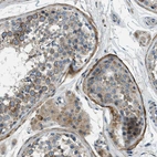 Immunohistochemical staining of human testis shows weak to moderate cytoplasmic positivity in cells in seminiferous ducts.
