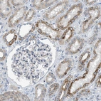 Immunohistochemical staining of human kidney shows moderate granular cytoplasmic positivity in cells in tubules.