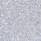 Immunohistochemical staining of human liver shows low positivity in hepatocytes as expected.