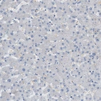 Immunohistochemical staining of human liver shows low positivity in hepatocytes as expected.