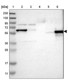 Lane 1: Marker [kDa] 230, 130, 95, 72, 56, 36, 28, 17, 11_br/_Lane 2: Human cell line RT-4_br/_Lane 3: Human cell line U-251MG sp_br/_Lane 4: Human plasma (IgG/HSA depleted)_br/_Lane 5: Human liver tissue_br/_Lane 6: Human tonsil tissue