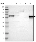 Lane 1: Marker [kDa] 230, 130, 95, 72, 56, 36, 28, 17, 11_br/_Lane 2: Human cell line RT-4_br/_Lane 3: Human cell line U-251MG sp_br/_Lane 4: Human plasma (IgG/HSA depleted)_br/_Lane 5: Human liver tissue_br/_Lane 6: Human tonsil tissue