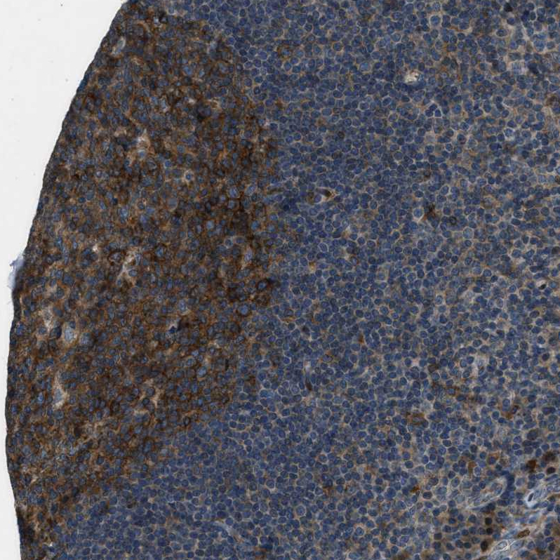 Anti-CLEC2D Antibody