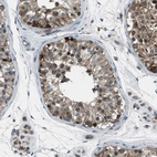 Immunohistochemical staining of human testis shows strong cytoplasmic positivity in cells in seminiferous ducts.