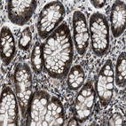 Immunohistochemical staining of human rectum shows strong cytoplasmic positivity in glandular cells.