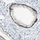 Anti-CYP4X1 Antibody