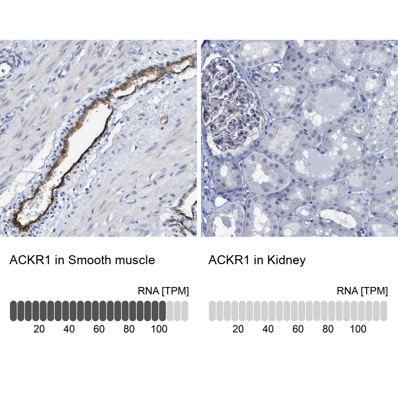 Anti-ACKR1 Antibody