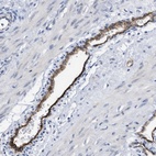 Anti-ACKR1 Antibody