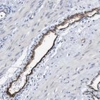 Immunohistochemical staining of human smooth muscle shows high expression.