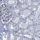 Immunohistochemical staining of human kidney shows low expression as expected.