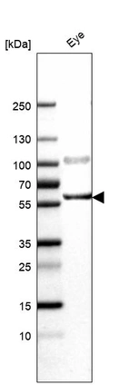 Western blot analysis in human eye tissue.
