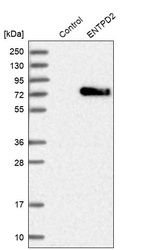 Western blot analysis in control (vector only transfected HEK293T lysate) and ENTPD2 over-expression lysate (Co-expressed with a C-terminal myc-DDK tag (~3.1 kDa) in mammalian HEK293T cells, LY404281).