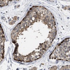 Anti-TMEM131 Antibody