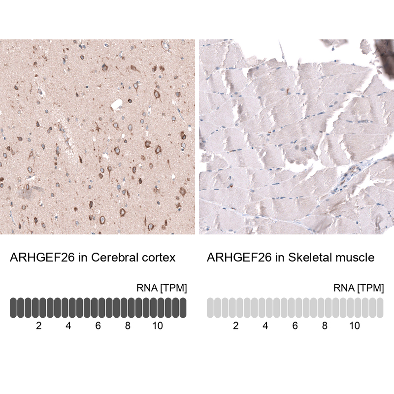 Anti-ARHGEF26 Antibody