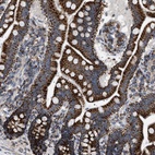 Anti-UBXN8 Antibody