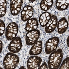 Immunohistochemical staining of human rectum shows high expression.